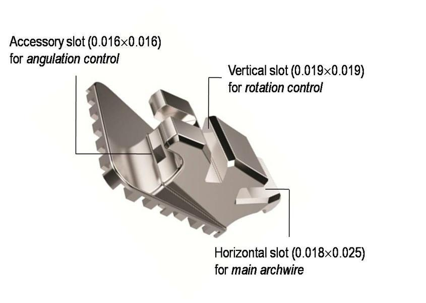 Multi-slotted Lingual Bracket - Anboini